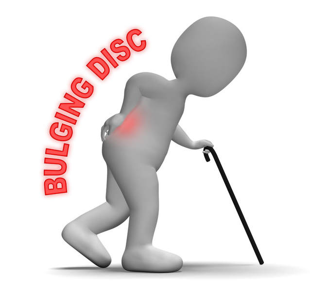 bulging disc issues redbank qld